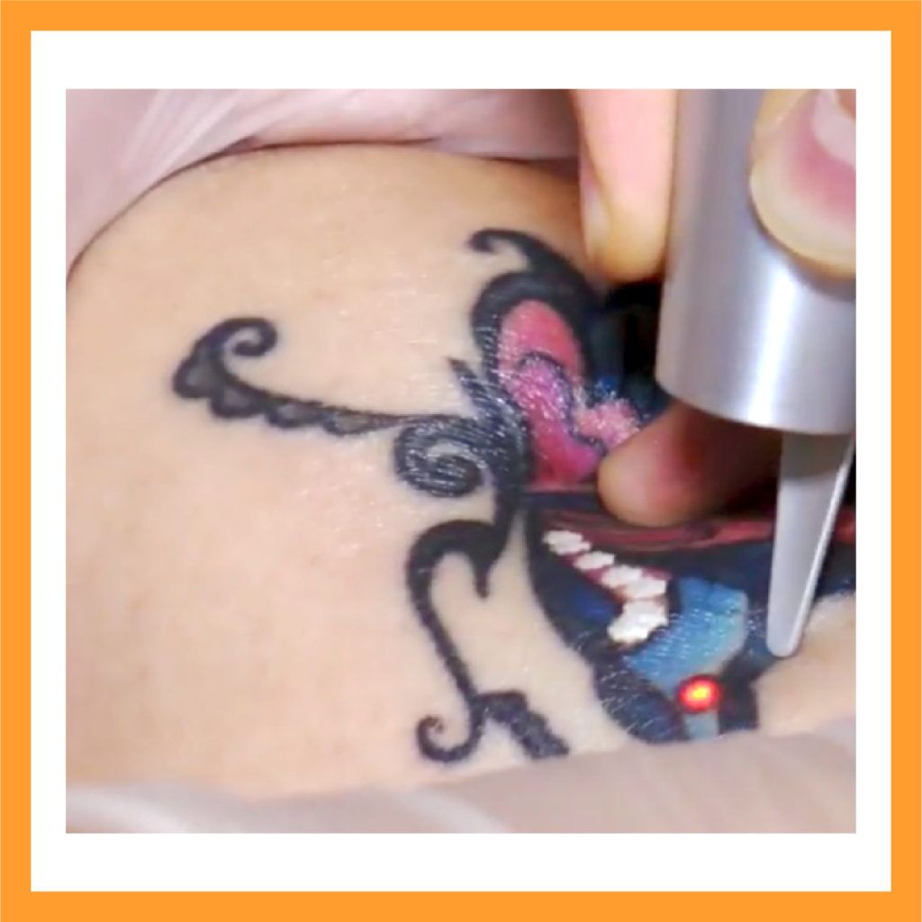 Portable Picosecond Red Light Laser Tattoo Skin Dark Acne Scar Spot Removal  Pen | eBay